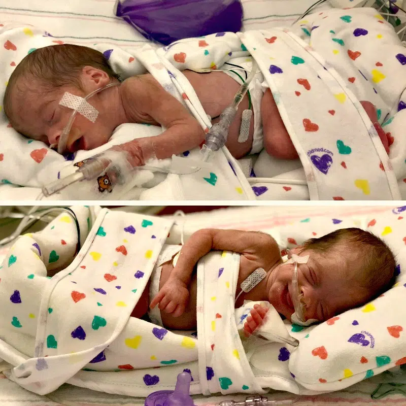 Read about how our 73 day NICU experience took a toll on our family and what to expect if you go through the same.