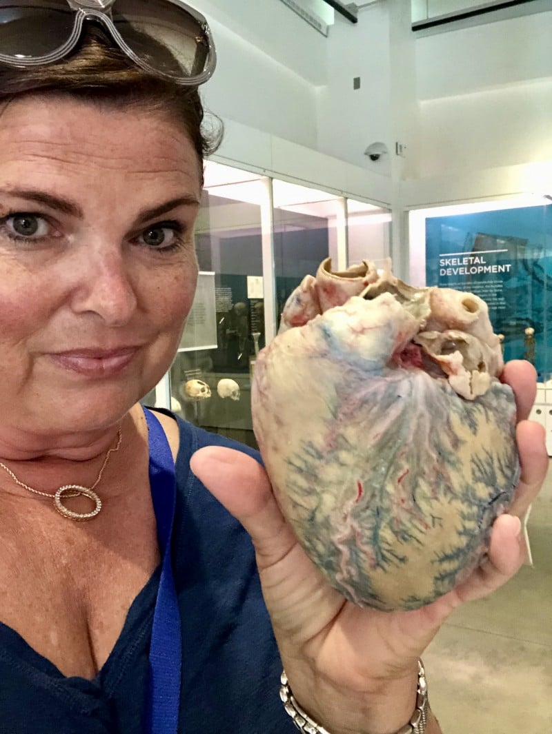 national museum of medicine human heart 